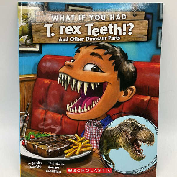 What If You Had T-Rex Teeth(paperback)